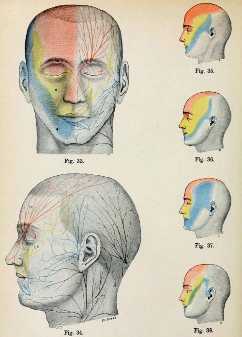 biomedicalephemera:  Area of distribution of the three branches of the trigeminal nerveThe trigeminal nerve (cranial nerve V) has three primary branches: the ophthalmic (V1), maxillary (V2), and mandibular (V3). Each of these branches has sub-branches,