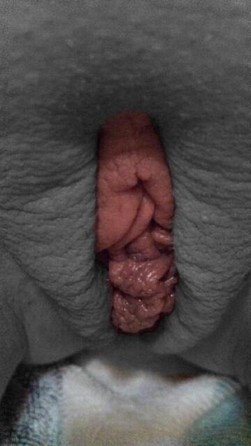 cummin4u