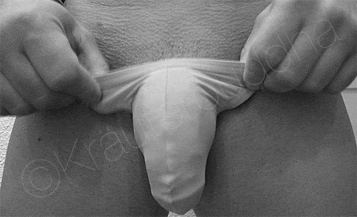 musclpkg:  Pouched
