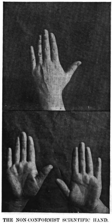 danskjavlarna: “The non-conformist scientific hand.”  The caption doesn’t ide