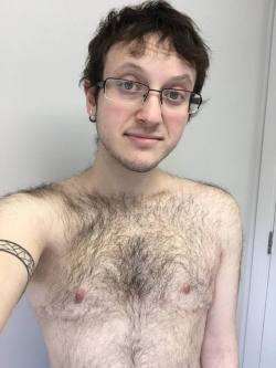 Horriblewarning: This Is What 5-Years Post-Op Looks Like (Well, When You’re Me,