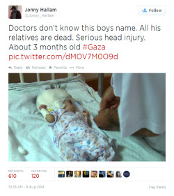 amiretfilistine:  Gaza: Doctors don’t know this boy’s name. All his relatives are dead. Serious head injury. About 3 months old.  