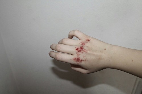 OFFLINE
