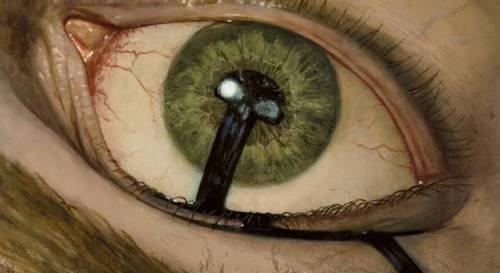 mtg-realm: Magic: the Gathering -  Conjunctivitis Is your Conjunctivitis leading to Rectal