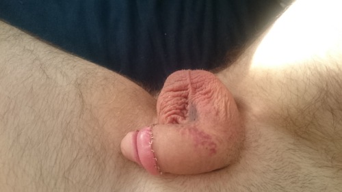 cutviking:  One week, 14 January. On the hour.   It’s itchy,  but the swellings have gone pretty much down since I took of the tapeband.  Please follow my cutviking.tumblr.com for new pics of me and my Norwegian cock!    What an improvement