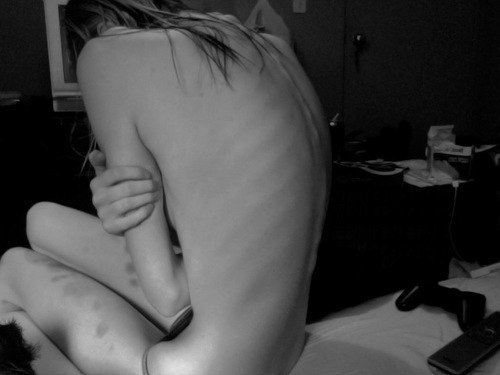 skinnydxeam:  xo