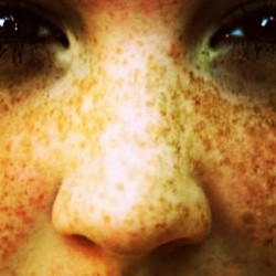 #Freckles #Major #Coverage #Instaphoto