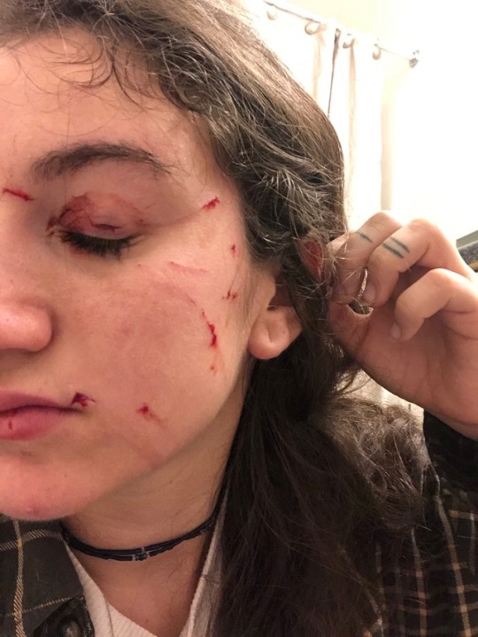 lividlovers:  rouge-matriarch:  peerless-cucumber:  ruinedchildhood:   So I’ve worked at cat villages and shelters and this my idea of why it attacked. Judging from her reaction it doesnt seem like shes very close to the cats (calling it cat instead