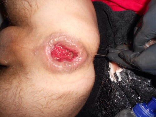 twohandssam:  fuckedupholes:  A bunch of nicely wrecked holes  Worth a repost.