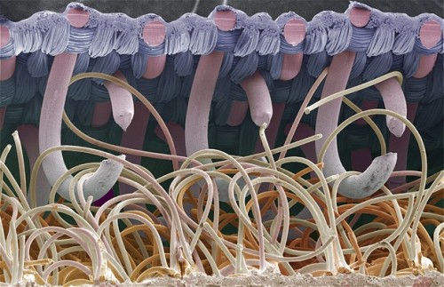 samsaranmusing:  Scanning electron microscope photos:  Needle and Thread Salt and Pepper Velcro 