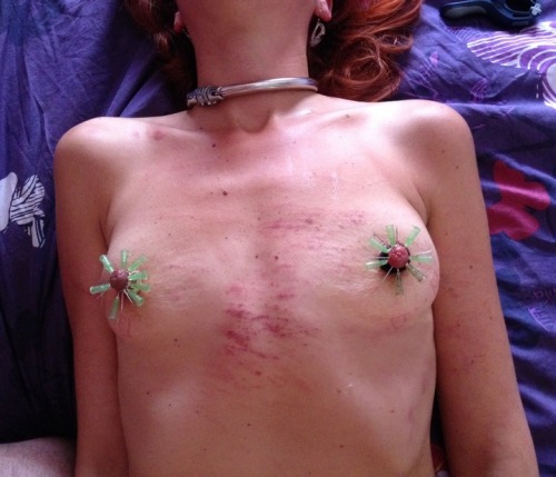 sadoslave:  Great needle arrangement…  Nice marks from the lash as well, very nice slave