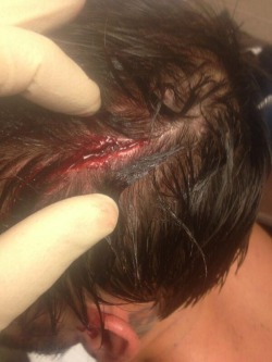 welovecmpunk:  From tonight.  :,( Oh damn! Poor Punk!!! WTF Heyman!!!