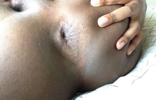 pullback718:  That Hole 😲