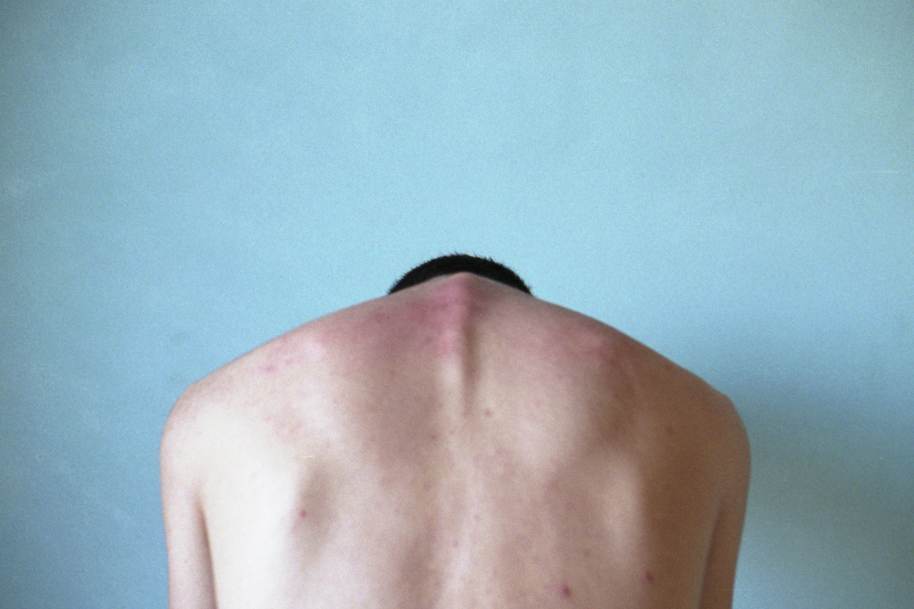 picsofyou:  Ductile with Canon Ft Ql follow me on: Flickr | Facebook | Society