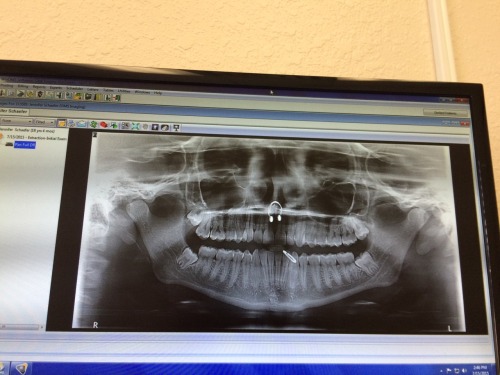 Sex The most badass X-ray that didn’t involve pictures