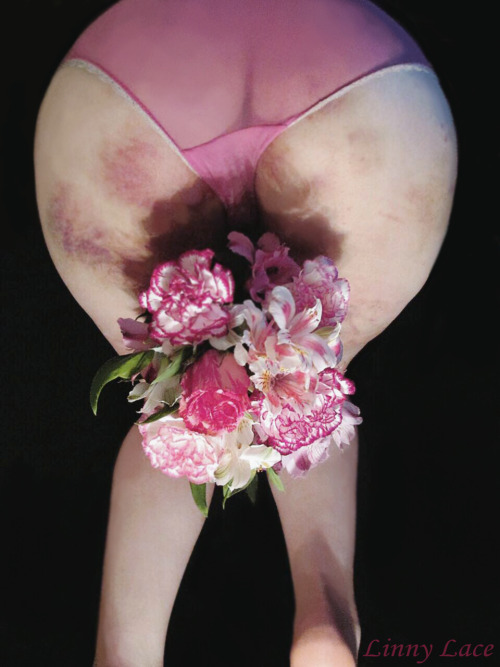 linnylace:Late Valentine’s Day post: this is easily becoming one of my favorite bruise-related photosets. The flowers were picked out specifically with my bruise colors in mind ♡  