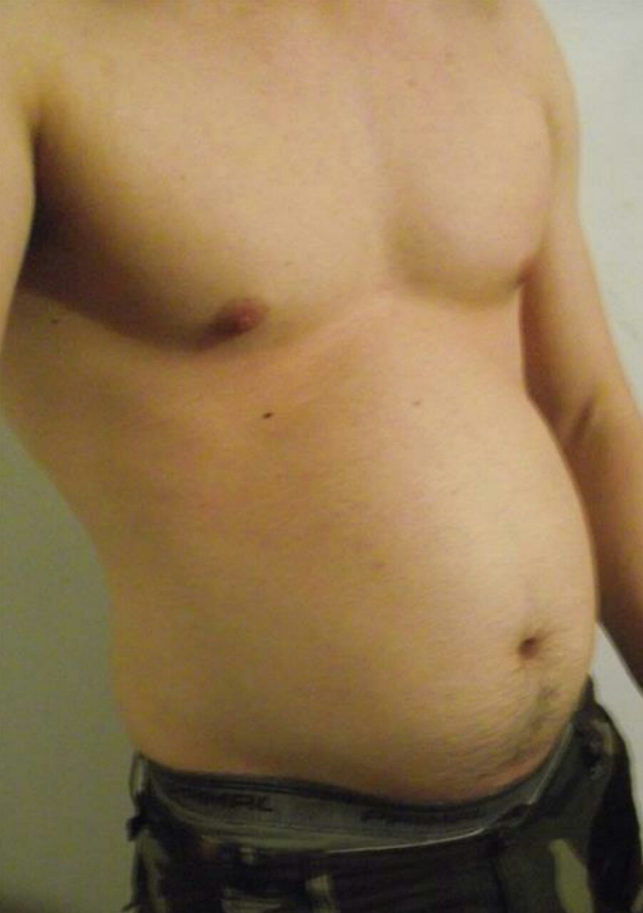 blogartus:  Probably started with the ripped bod and added the beachball belly. That’s