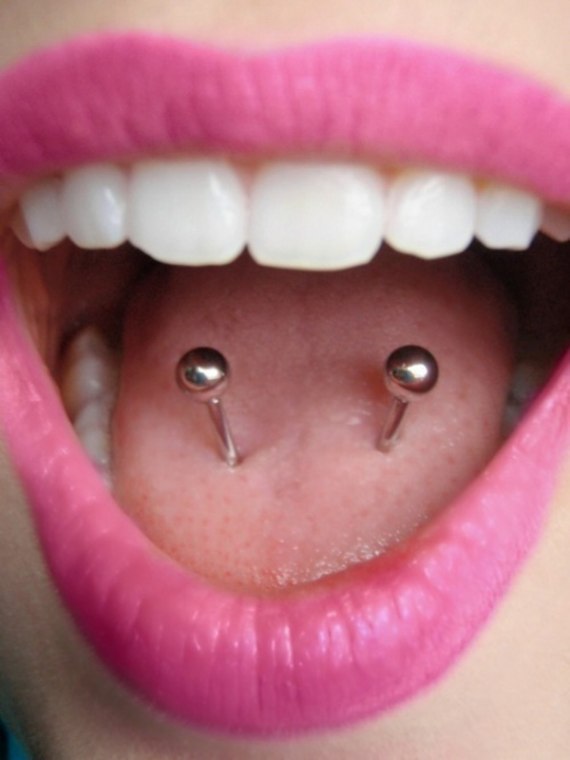 Yes please.