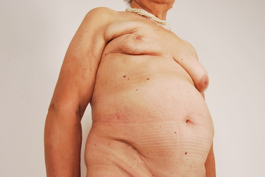 oo111111:  Nu Enfermo, 2012 Bruna Amaral