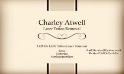 I have APPOINTMENTS for laser tattoo removal next week #kettering #Essex #Northamptonshire get in touch for bookings also spaces on Saturday 16th in Kettering! #lasertattooremoval #tattoo #laser by charleyatwell