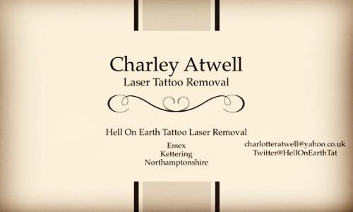 I have APPOINTMENTS for laser tattoo removal next week #kettering #Essex #Northamptonshire get in touch for bookings also spaces on Saturday 16th in Kettering! #lasertattooremoval #tattoo #laser by charleyatwell