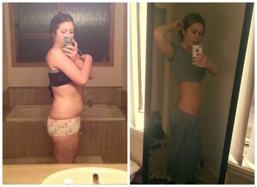 Before and after weight loss photos Are you making this common Weight Loss mistake? Click here to fi