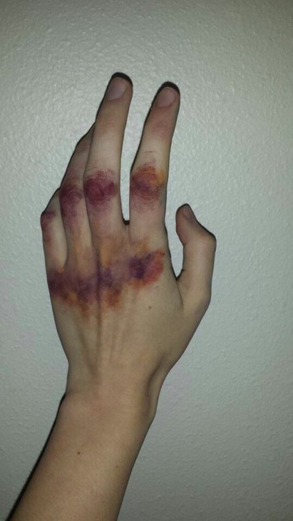 aesthetic hands