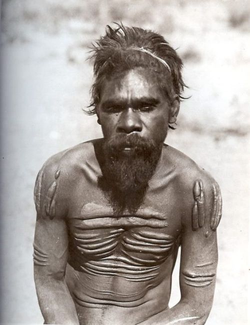 indigenouswisdom: Aboriginal and Torres Strait Islander people are advised that this post contains images of people who have passed away.  Jingili man with cicatrices. Northern Territory, Australia.1901Walter Baldwin Spencer