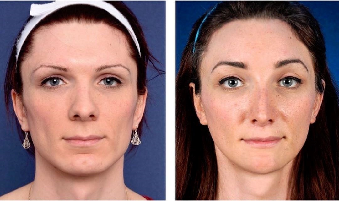 Free virtual plastic surgery Free virtual plastic surgery