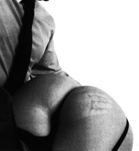 super-sweet-peas:  Ouchies