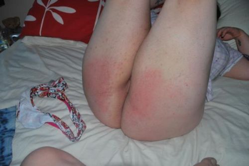 XXX legs-up-spankings:  Lovely picture from disciplineinthehomeandschool photo