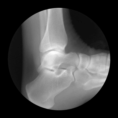 ratak-monodosico:  X-Ray Gifs Cameron Drake 