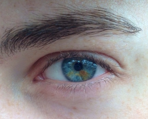 myregularneed:  Heterochromatic eye
