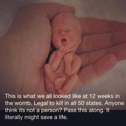 shadowsofstars:  Al-fucking-righty - I did NOT want to have to do this, but if I don’t vent here, I may punch a relative in the face. THIS IS NOT A 12 WEEK OLD FETUS. Did you catch that? No? Let me try again: THIS IS NOT A 12 WEEK OLD FETUS. A 12 week