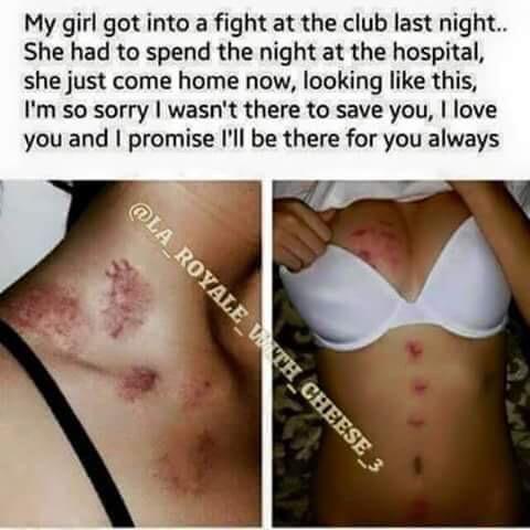 youngblackqueen:  biracial-queenn:  56blogscrazy:  yea she got beat up real good   😂😂😂😂😂😂  lmaooo 