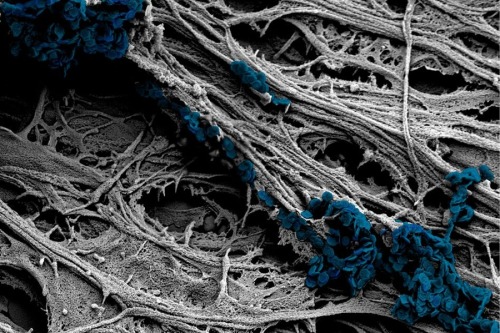 (Image caption: A scanning electron microscope image of cultured neural cells shows the team’s newly