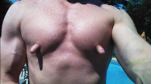 Nipplemania