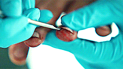 jenniiferlawrence:  30 Days of Hannibal (x)Day 11: Extreme close ups  