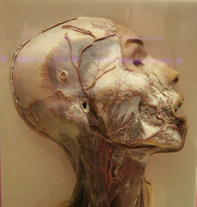 museum-of-odd:  This dissection highlights the muscles of the head and neck. The