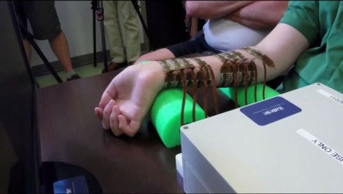 thenewenlightenmentage: New Device Allows Brain to Bypass Spinal Cord and Move Paralyzed Limbs For t