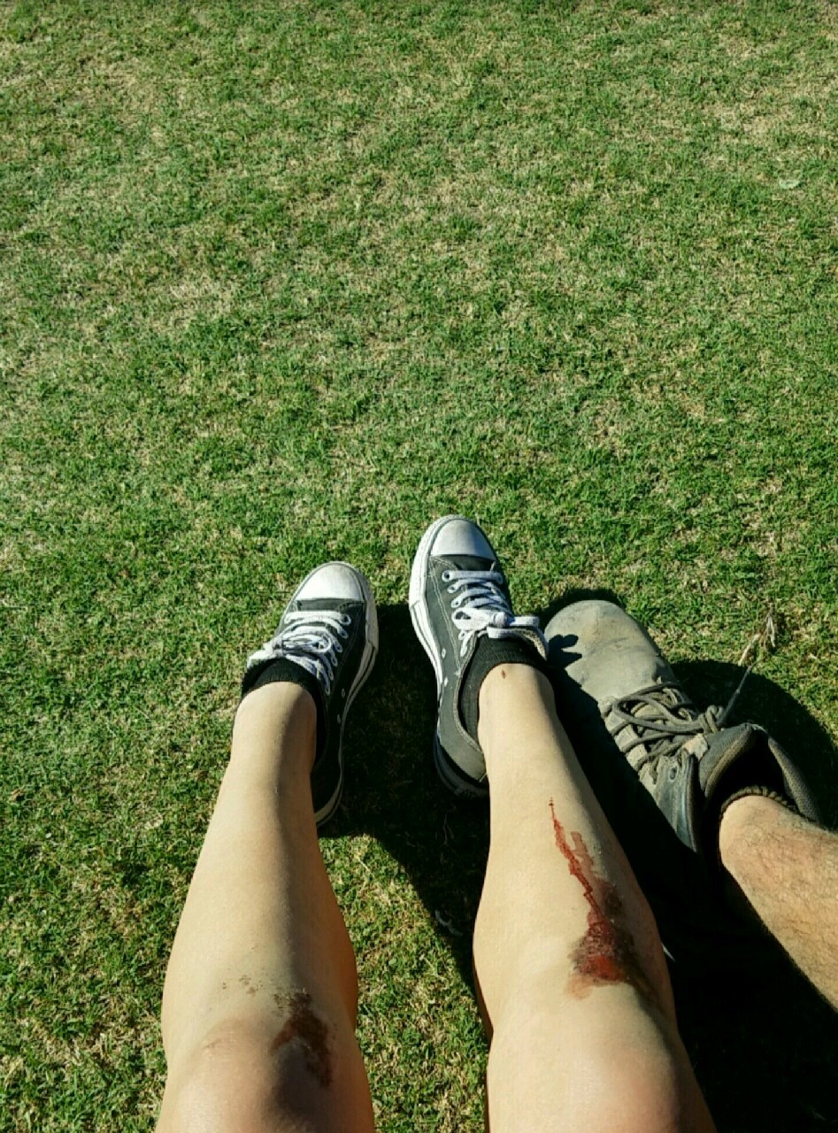 Bloody knees, messed up my ankle, and bruises. Needless to say Ozzfest meets Knotfest