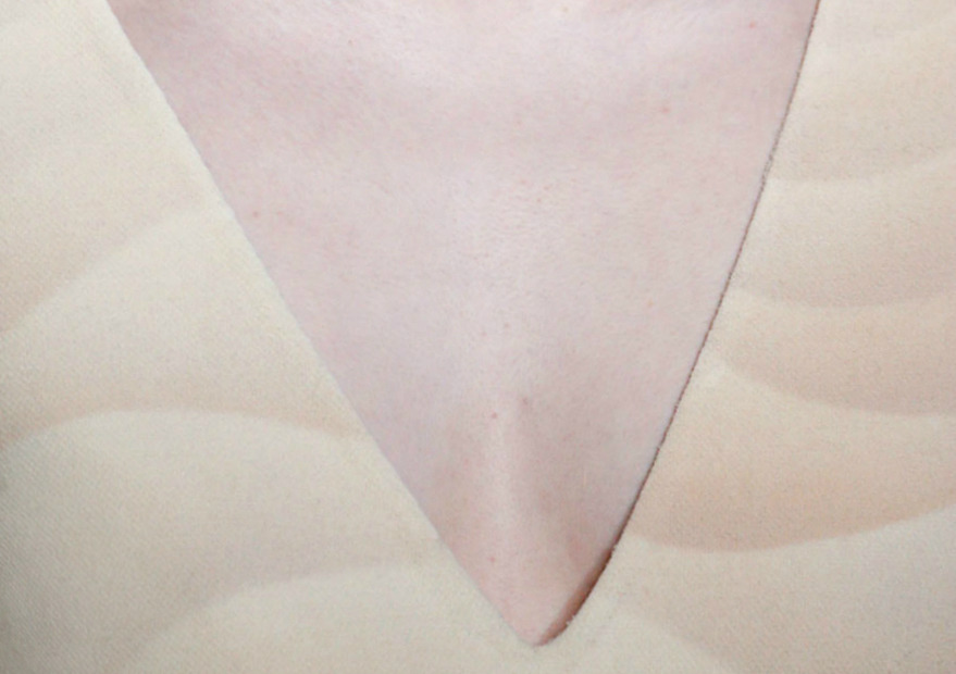 lamorbidezza:  Marc Jacobs Fall 2014 Details