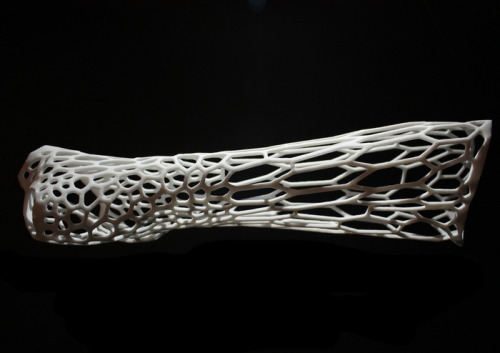 3D printed exoskeletal cast by Jake Evill. More info.