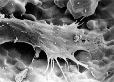 zizzerzazzerzuzz:Human long bone cell growing on the surface of a hydroxyapatite ceramic foam