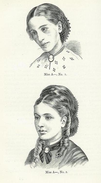 XXX The case of Miss A, pictured in 1866 (at photo