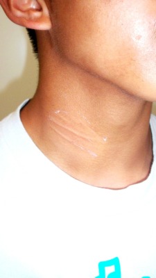 ahhhh i put on a salonpas patch cuz i couldn&rsquo;t stand my aching neck.. i took it off before i got into the shower and got these wierd looking marks haha. they should go away..i think i had the patch on too long, hahah. 