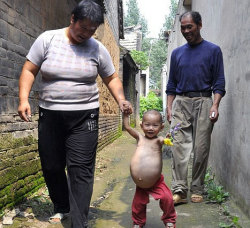 alfreddosauce:  ngooocmai:  gildoww:  WTF PREGNANT 1 YEAR OLD GIRL!  BEIJING – CHINESE doctors were shocked when they discovered a one-year-old girl was carrying a baby in her stomach.According to media outlets on Wednesday, Kang Mengru, 1, worried