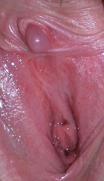 submitmomsnwives:a wet dream Another shot of that big Pearl of a Clit!!! Thanks. Submitted by Anon