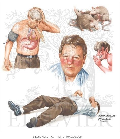 tristn:
“Netter Medical Illustrations - Alcohol Withdrawal
”
See? See? That is what I’d be facing.
No, thanks.