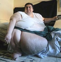 Obesity is the best.
